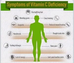 Vitamin C Deficiency Diseases