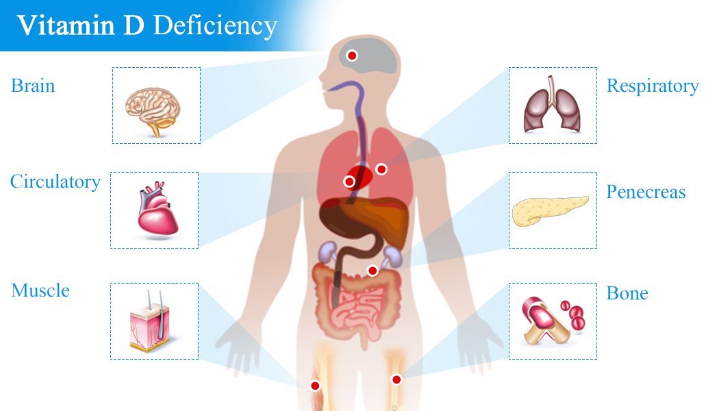 Vitamin-D deficiency symptoms 